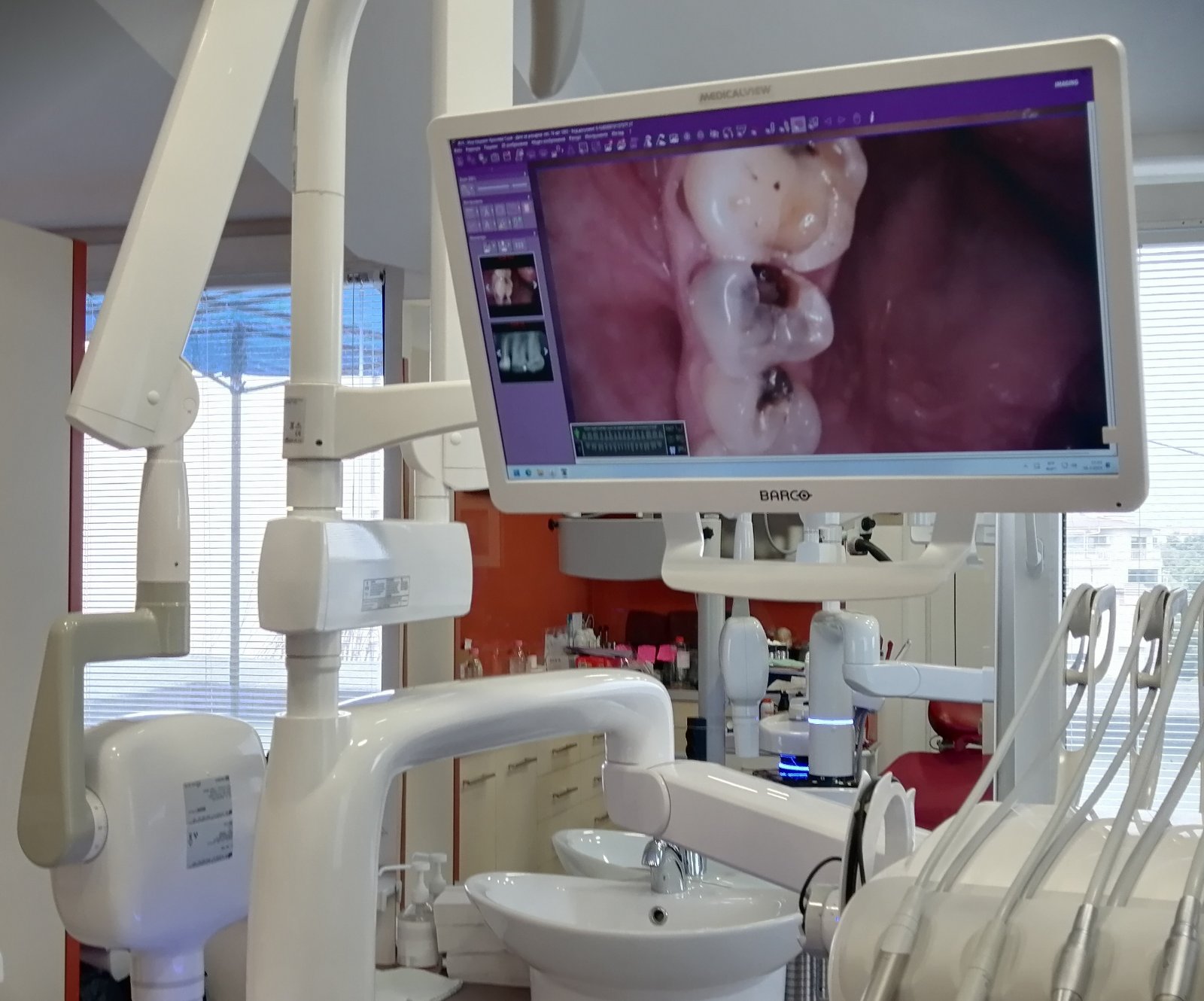 В „Медикус Алфа”: Революционен дентален юнит осигурява диагностика и лечение в един апарат