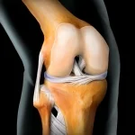 Пациентка премина успешно през рядка и високоспециализирана ревизионна операция в Еврохоспитал Пловдив