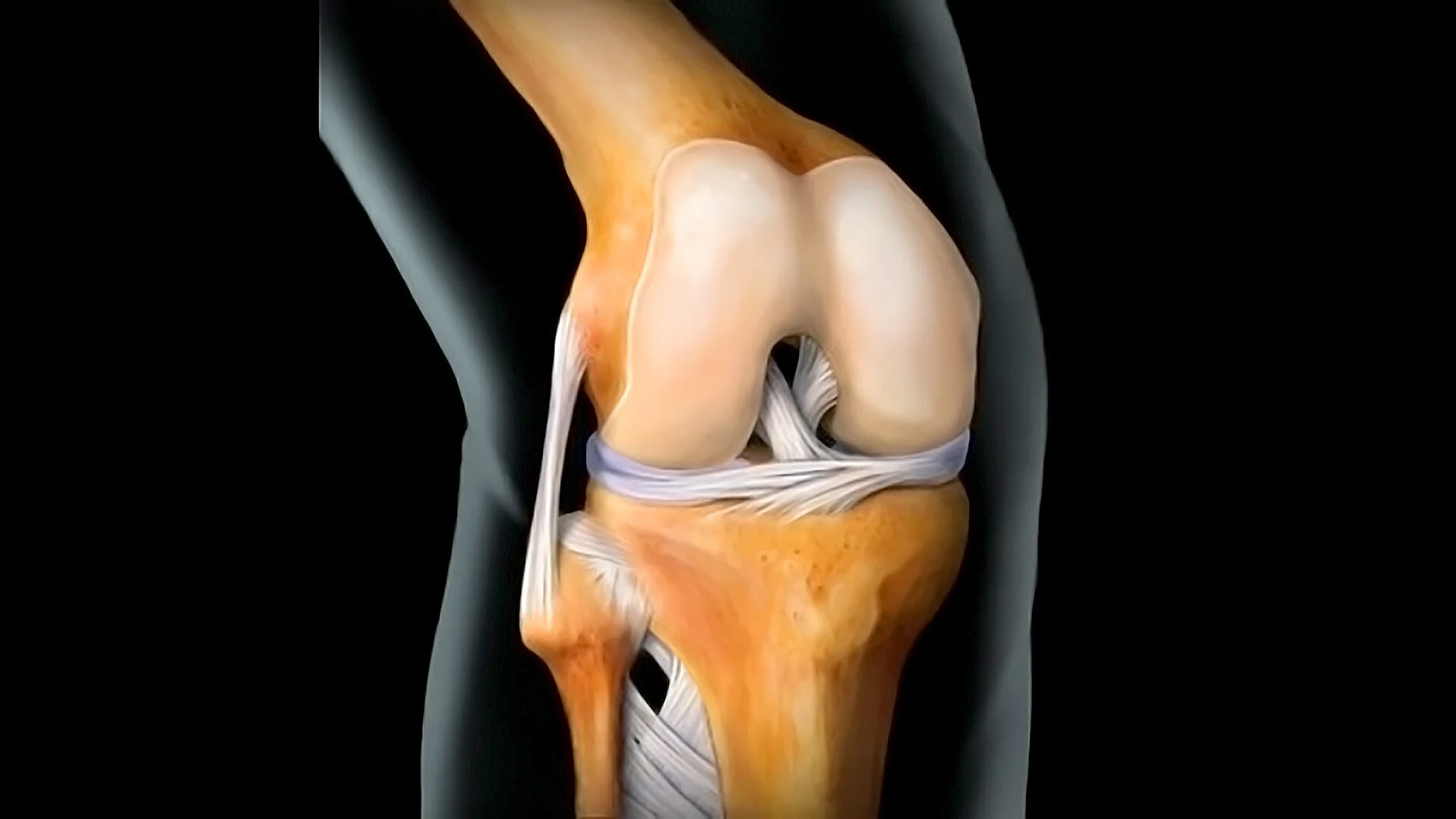 Пациентка премина успешно през рядка и високоспециализирана ревизионна операция в Еврохоспитал Пловдив